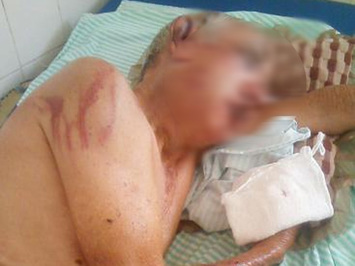 Idoso é espancado durante assalto na cidade de Castelo do Piauí