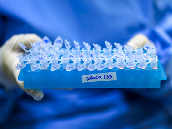 Piauí já ultrapassa 5 mil casos confirmados do novo Coronavírus